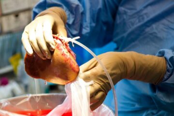 Haïti face à l’horreur du trafic d’organes humains, où des citoyens sans défense deviennent des marchandises au profit des plus puissants, quand la justice se tait et que l’État regarde ailleurs